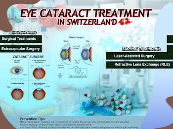 Cataract Treatment in Switzerland: Complete Guide to Symptoms & Surgery
